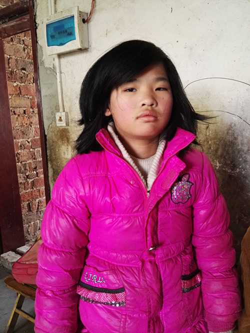 唐慧黠(已中止资助)